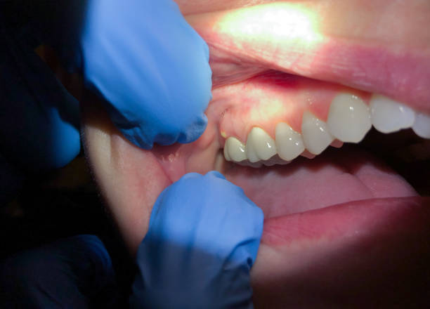 Best Emergency Cosmetic Dentistry in Gig Harbor, WA