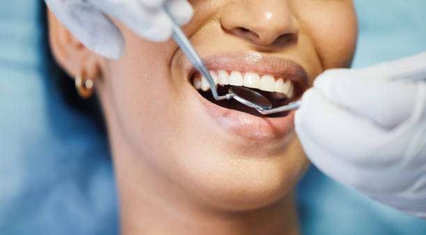 Best Broken or Cracked Tooth Emergency Dentist in Gig Harbor, WA